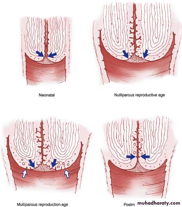premalignant conditions of cervix