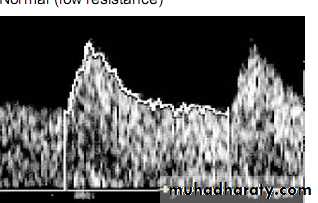 Hypertension_during_pregnancy