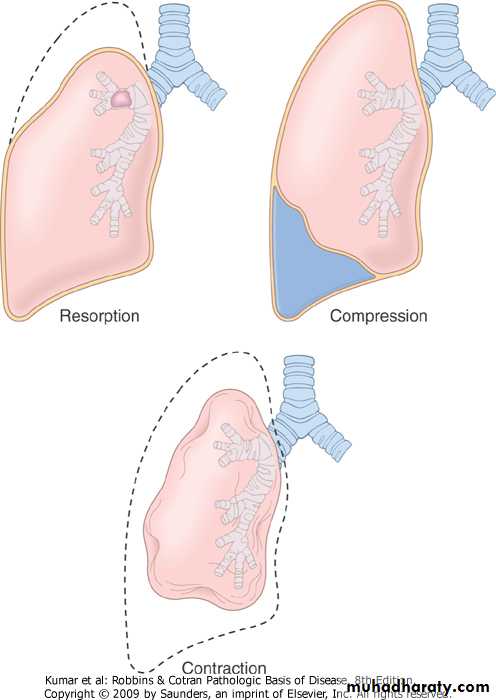 Respiratory System