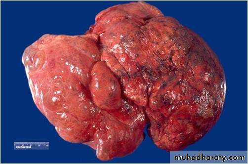Respiratory System