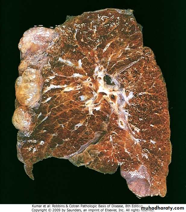 Respiratory System