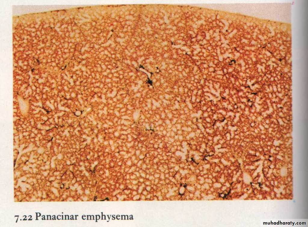 Respiratory System