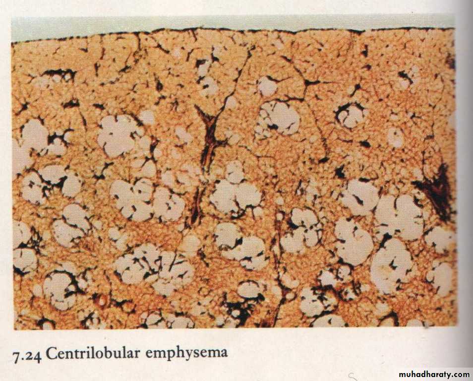 Respiratory System