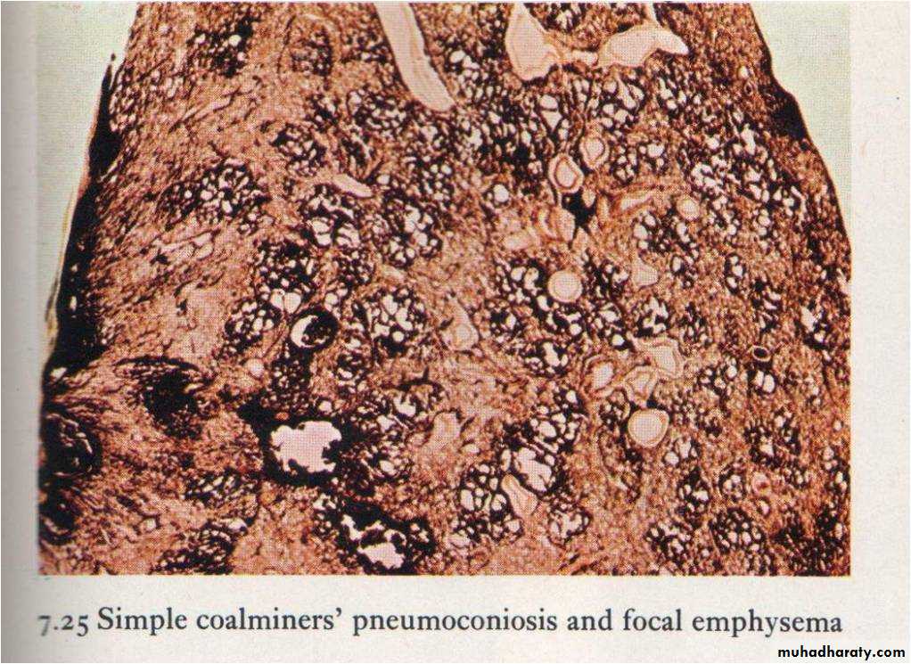Respiratory System