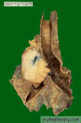 Respiratory System