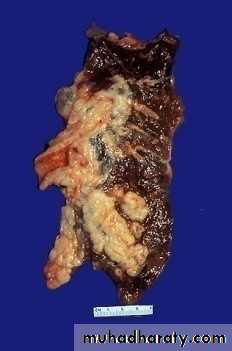 Respiratory System