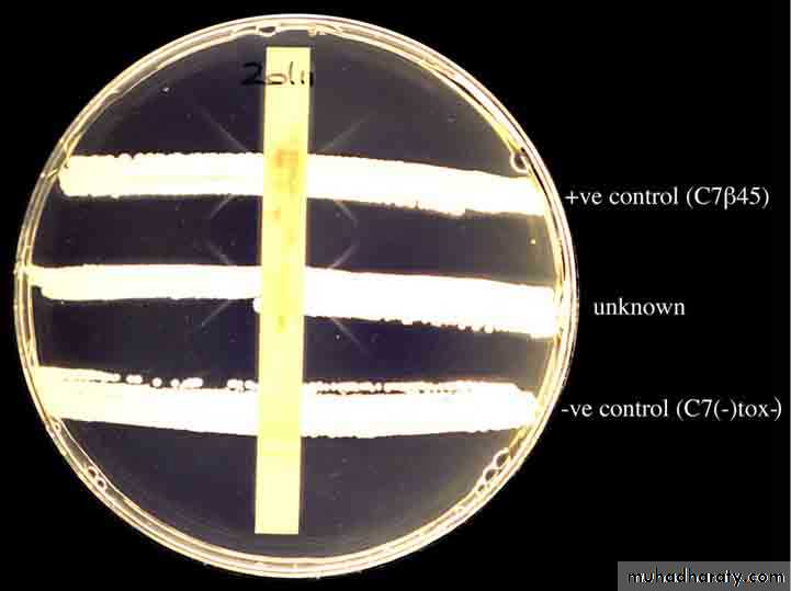 Corynebacterium