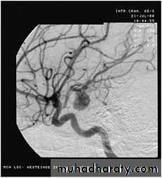 Arterial Disorders