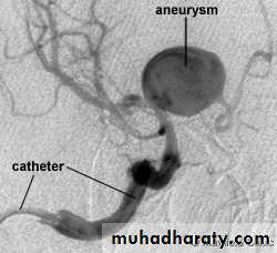 Arterial Disorders