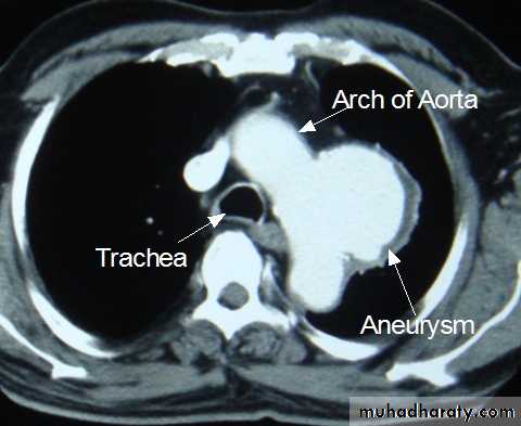 Arterial Disorders