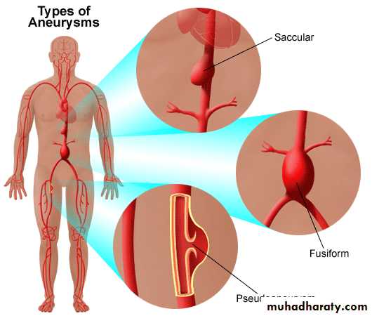 Arterial Disorders