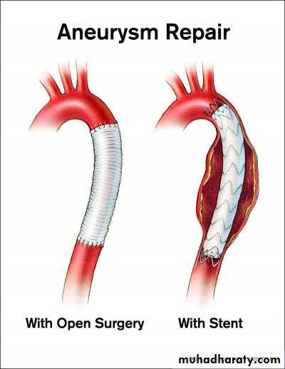 Arterial Disorders