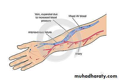 Arterial Disorders
