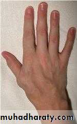 Arterial Disorders