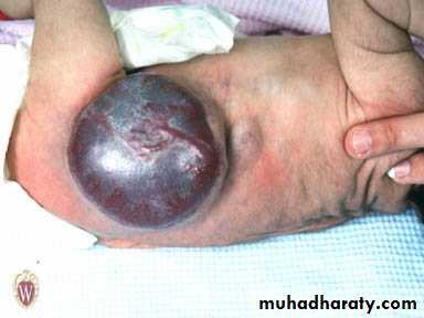 Arterial Disorders