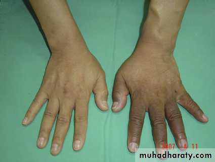 Arterial Disorders