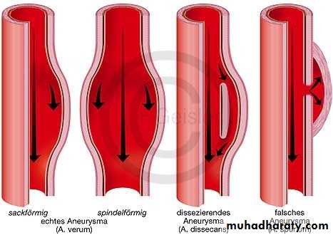 Arterial Disorders