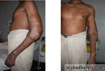 Arterial Disorders