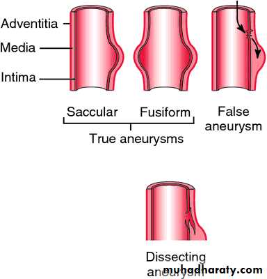 Arterial Disorders