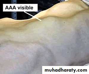 Arterial Disorders