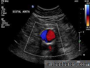 Arterial Disorders