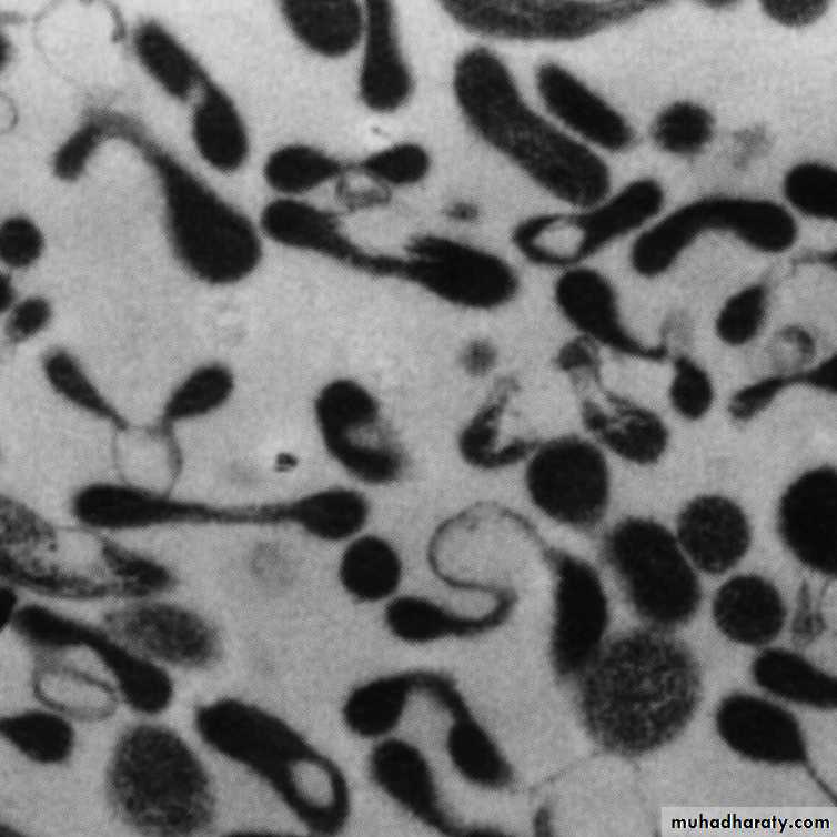 Cell Wall Defective Bacteria