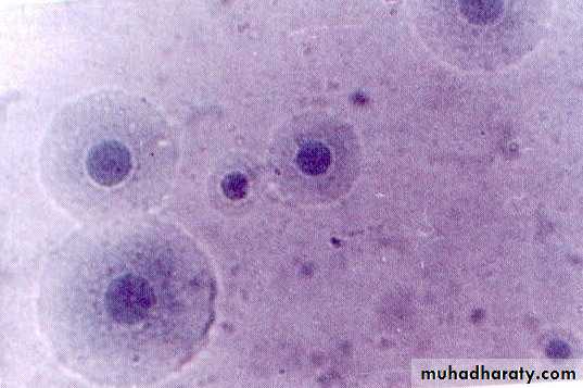 Cell Wall Defective Bacteria