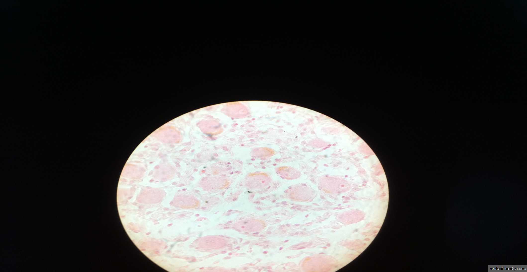 Ganglia