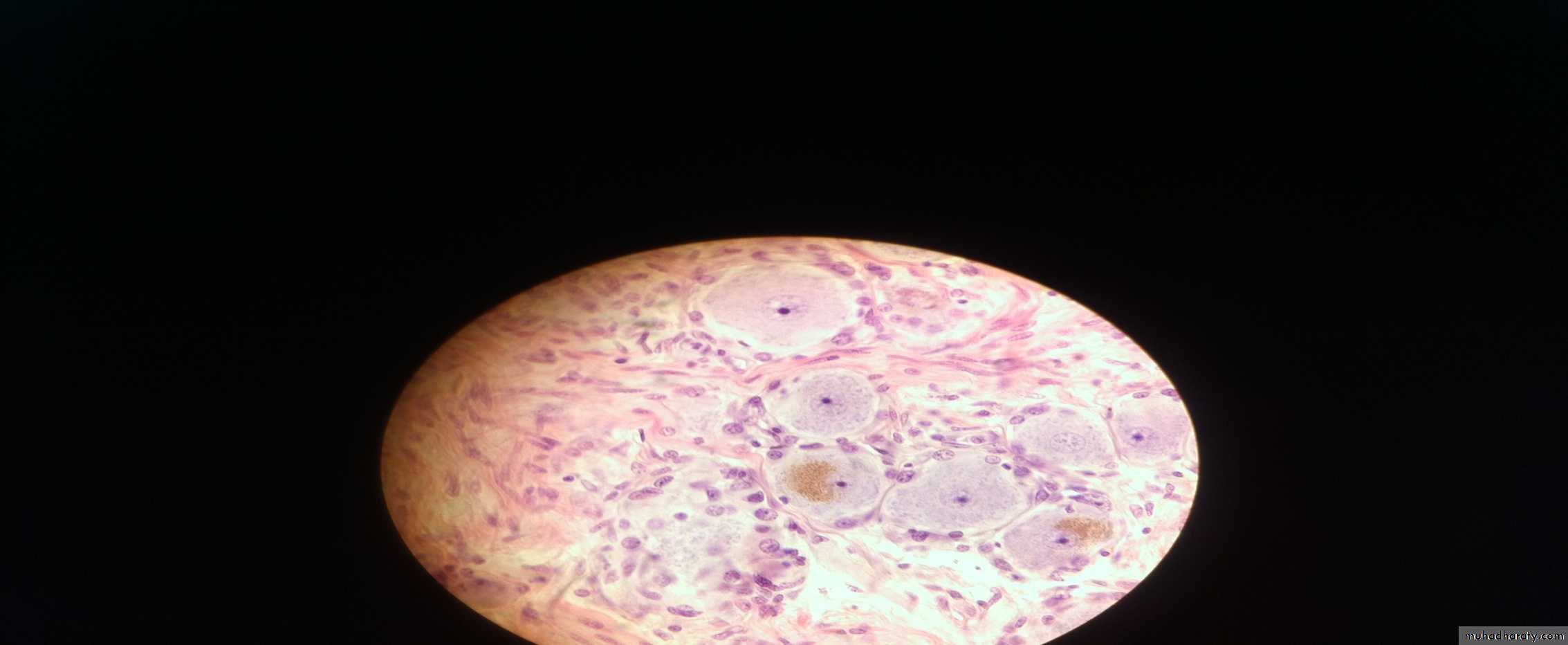 Ganglia
