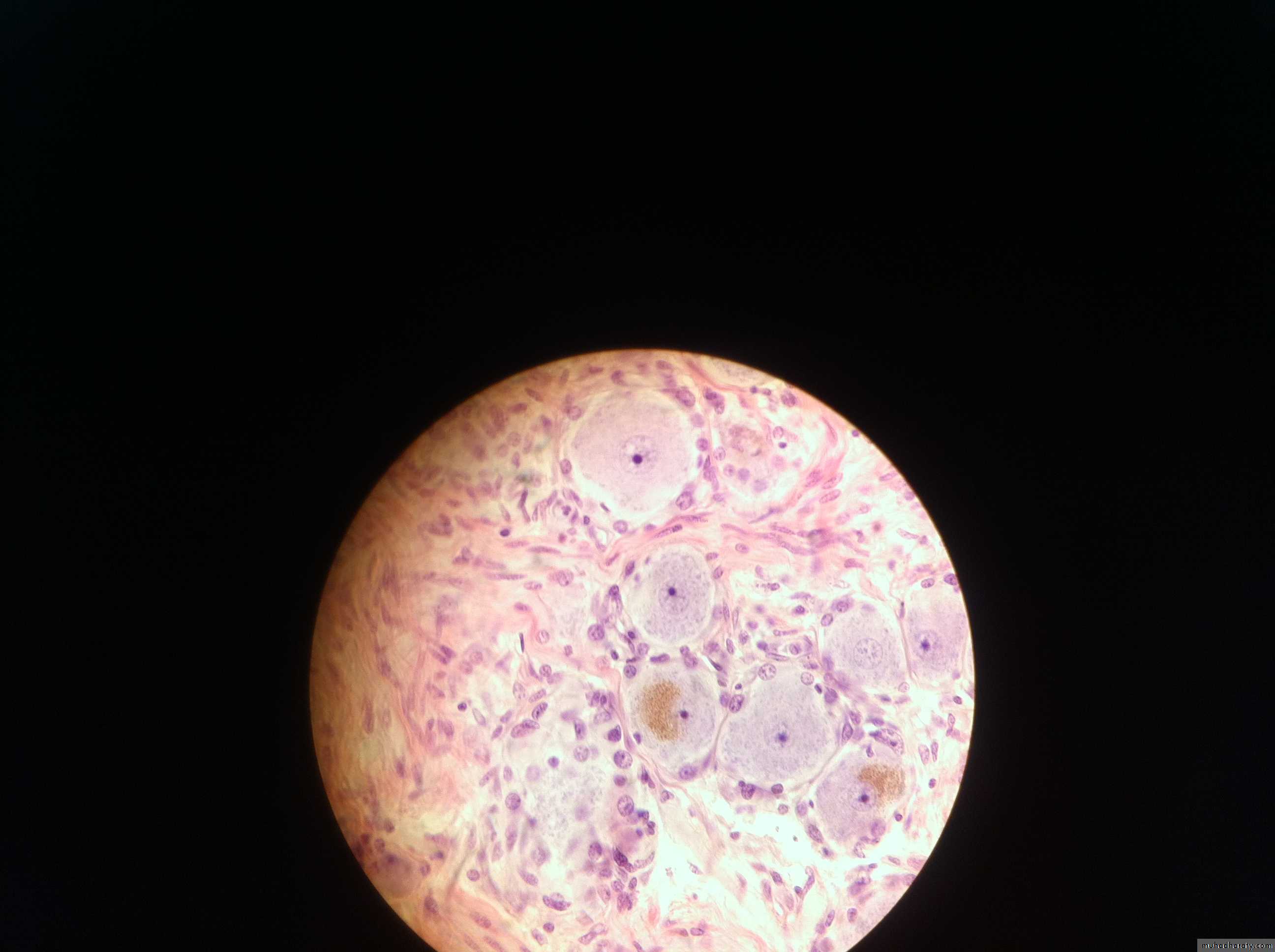 Ganglia