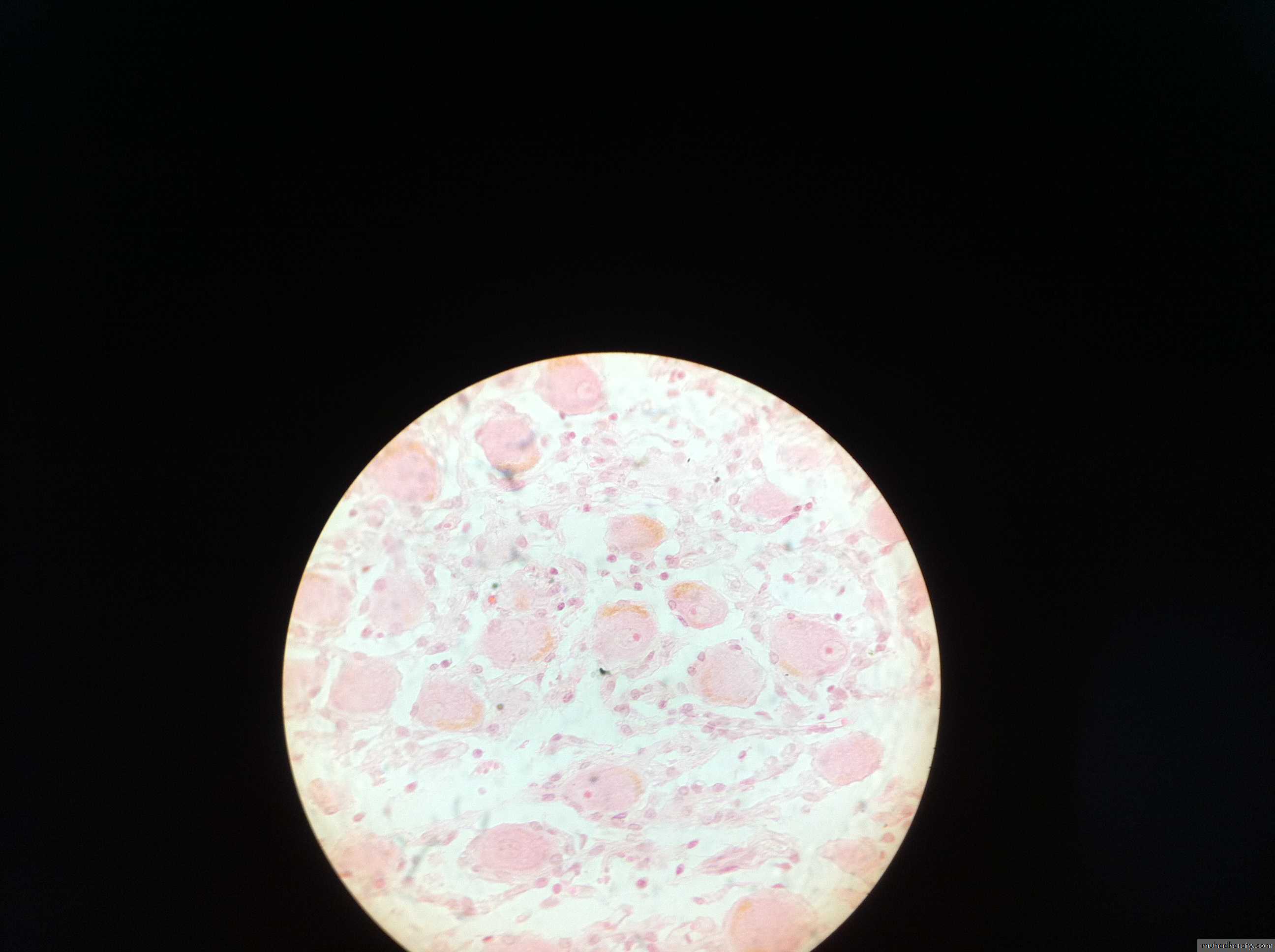Ganglia