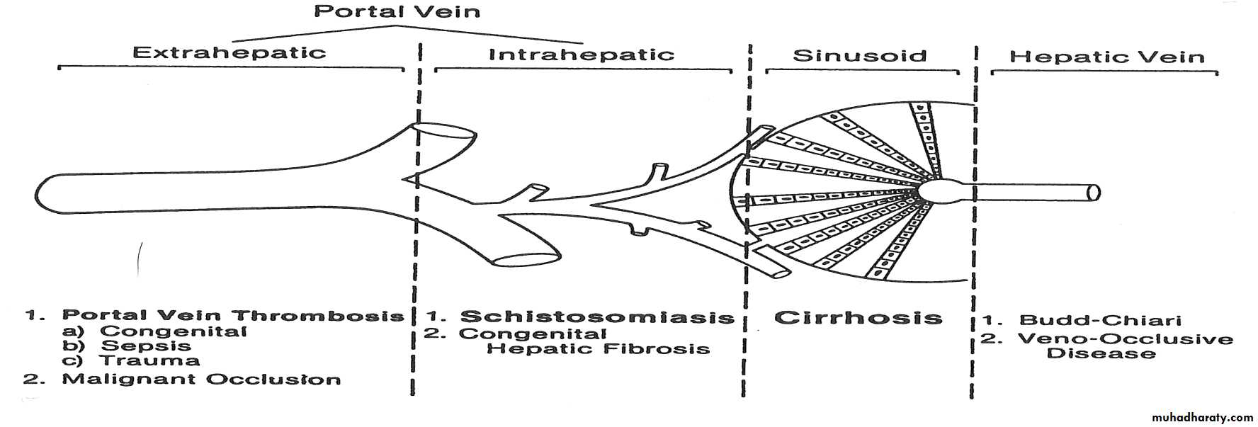 Portal Hypertension