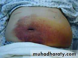 Pancreas 1