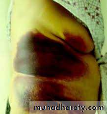 Pancreas 1