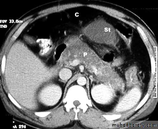 Pancreas 1