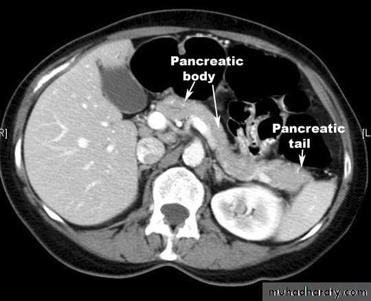 Pancreas 1