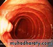 Pancreas 1