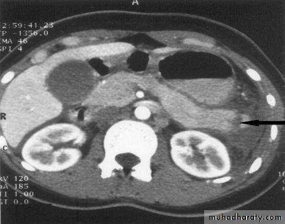 Pancreas 1