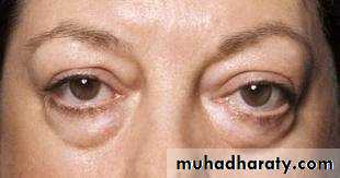 General Examination