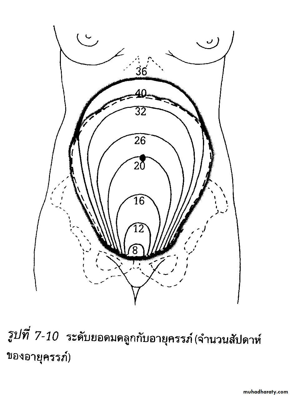 dx of pregnancy