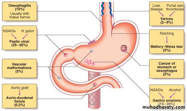upper GI bleeding