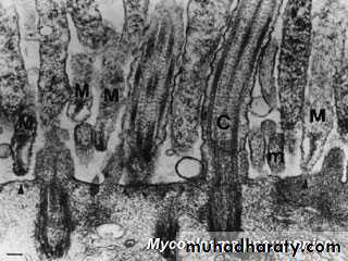 Pneumonia