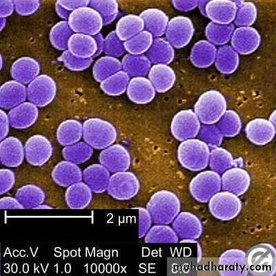 Pneumonia