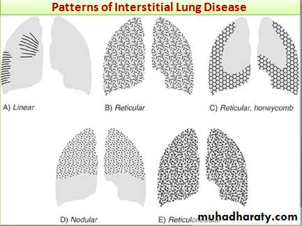 Interstitial Lung Diseae