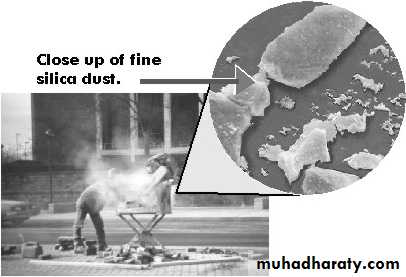 Interstitial Lung Diseae