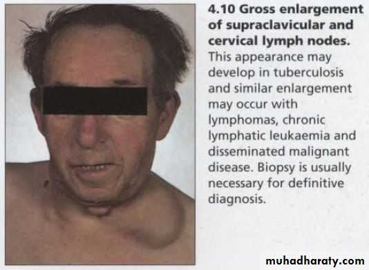 OSCE photos