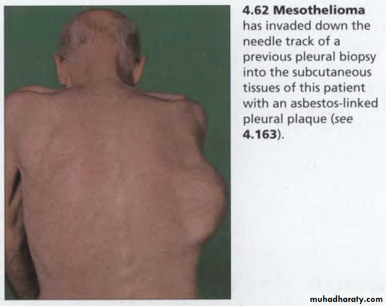OSCE photos