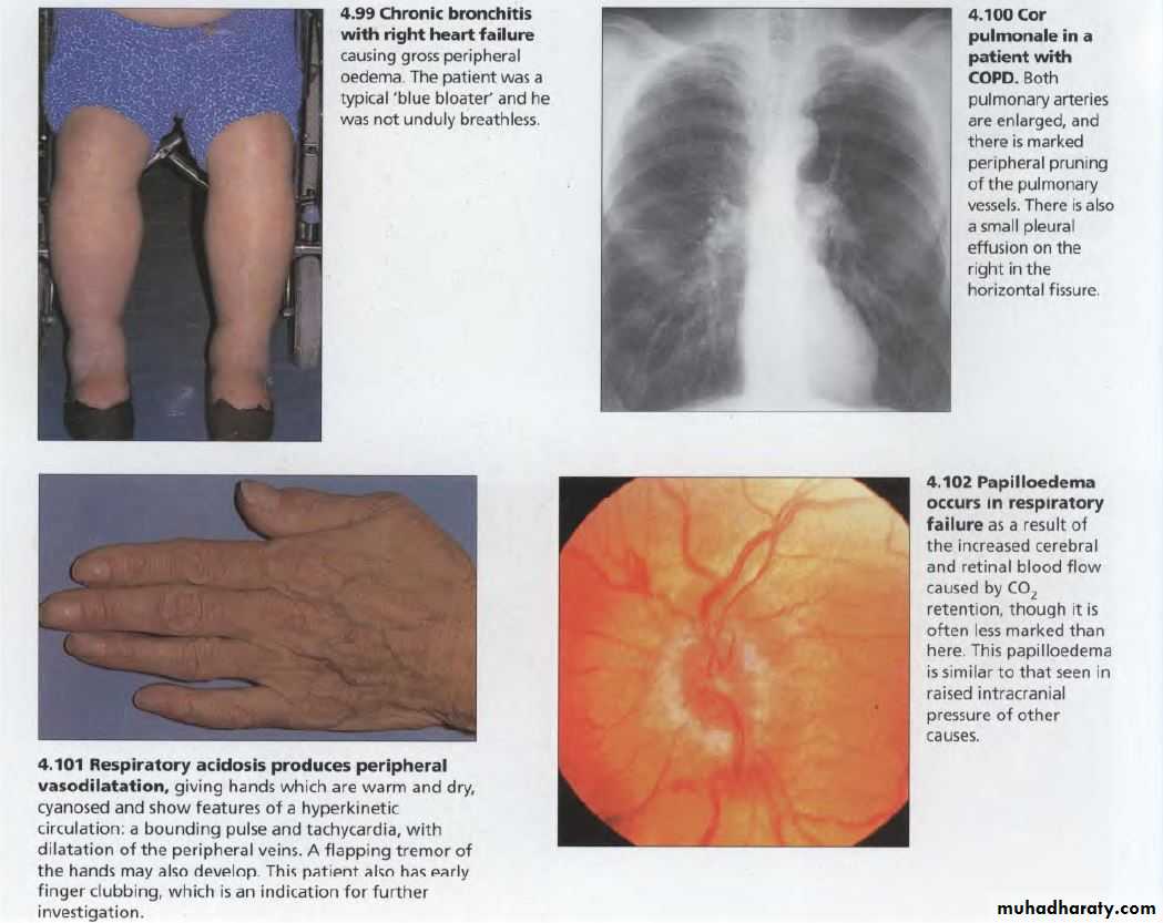 OSCE photos