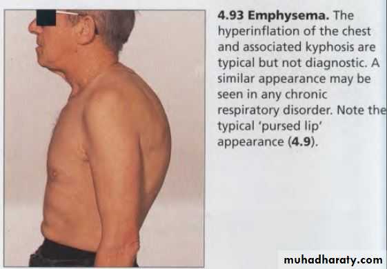 OSCE photos