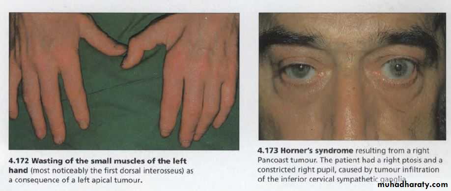 OSCE photos